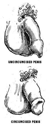 An uncircumcised penis with the foreskin fully covering the head and a circumcised penis with the head exposed.