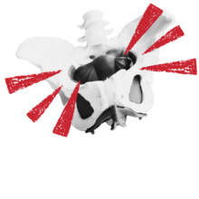 a skeleton pelvis with ouchy red lines coming out of it